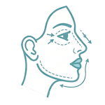 Facial procedures